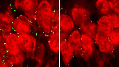 How Marijuana May Damage Teenage Brains in Study Using Genetically Vulnerable Mice