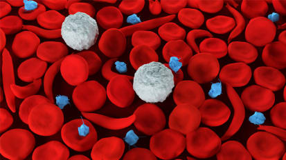 Study Affirms Challenges in Managing Severe Pain of Sickle Cell Disease