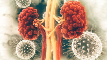 Johns Hopkins Research Shows Potential for Cure for Polycystic Kidney Disease