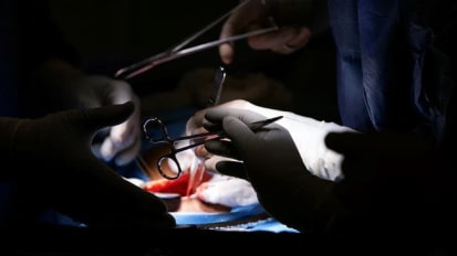 Kidney Transplant Equity