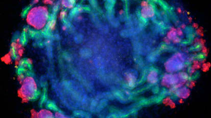 Genome Editing to be Tested in Kidney Organoids