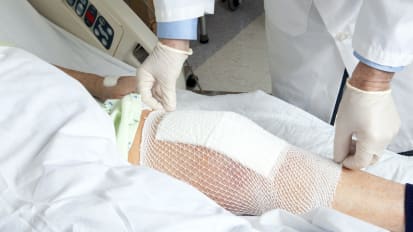 Age, sex, race among top risk factors for revision knee surgery