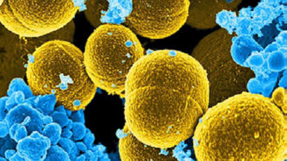 Link Between ‘Leaky Gut’ and Immune Dysfunction in HIV-Positive Patients