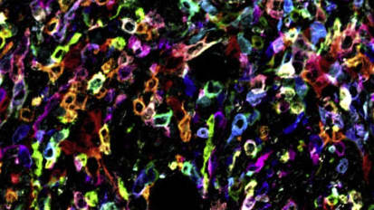 A Colorful New Approach to Identifying Regulators of the Tumor Microenvironment