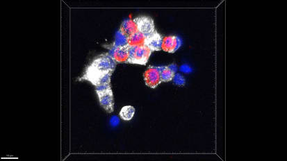Diabetes, Obesity and Metabolism Institute Advances Understanding of Beta Cells and More