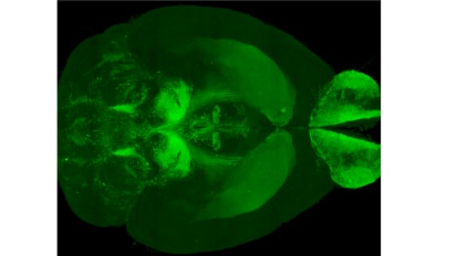 A Study of Subtypes of Dopaminergic (DA) Neurons in the Brain Could Open a New Chapter in Treating Parkinson’s Disease