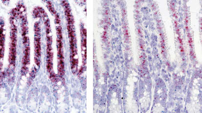 Mount Sinai-Led Team Identifies Cellular Mechanisms That May Lead to Onset of Inflammatory Bowel Disease