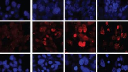 Probing “DNA Damage Repair Genes” to Change Outcomes for Castration-Resistant Prostate Cancer