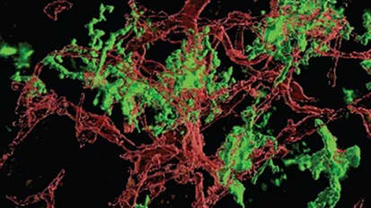 Microglia Could Be The Key to Slowing Invasion and Relapse in Glioblastoma