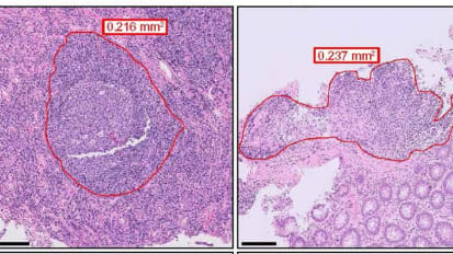Gastroenterology and GI Surgery 2025