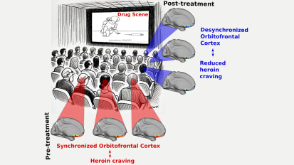 Academy Award-Nominated Movie Helps Researchers Identify Brain Region Biased Towards Drug Cues and Treatment Effects in Individuals With Heroin Use Disorder