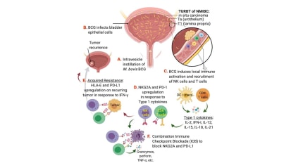 A Mount Sinai Team of Urologic Researchers Advances a Unique Model of Bladder Cancer Resistance