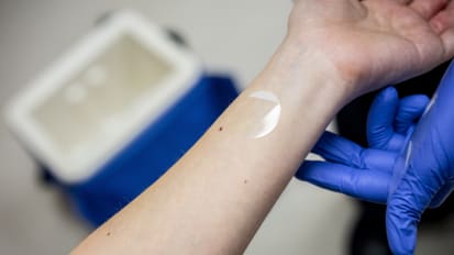 Skin Tapes May Be a Game Changer for IBD