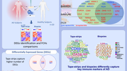 Using Tape Strips Advances Research in Atopic Dermatitis and Other Skin Diseases