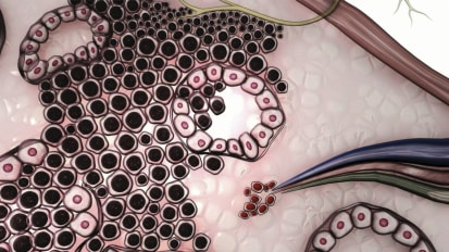 Saline-Assisted Fascial Engorgement (SAFE): An Innovative Technique for Robot-Assisted Laparoscopic Radical Prostatectomy