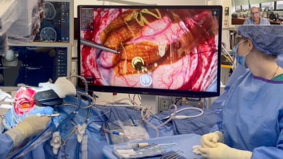 Connecting the Human Brain to Artificial Intelligence: What Early Clinical Experience at Mount Sinai Is Revealing about Brain-Computer Interfaces