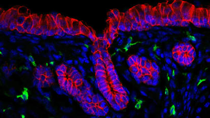 Investigating the Role Macrophages Play in the Formation of Healthful Respiratory Submucosal Glands