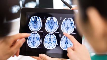 Optimizing Care Following Traumatic Brain Injury: Rapid Laboratory Test Offers Opportunity for Paradigm Shift 