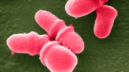 Gut Microbes May Lead to Therapies for Mental Illness, UTSW Researcher Reports