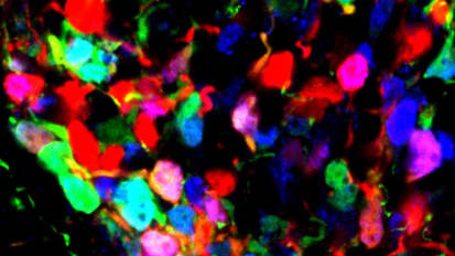 Developmental ‘switch’ in brain may shape lifelong obesity risk