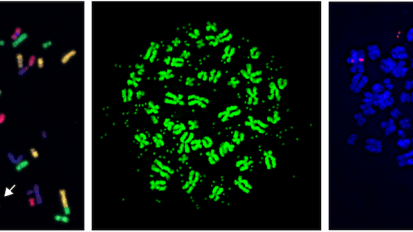 Pathway tied to cancer-driving genome alterations identified