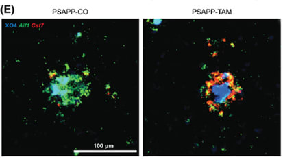 Mount Sinai Researchers Identify the Role of an Alzheimer’s Disease Risk Gene in the Brain