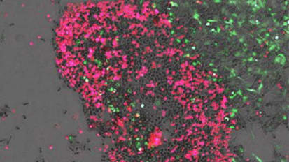 Neuroblastoma Research