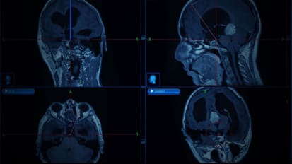 Neurology & Neurosurgery Specialty Report 2021