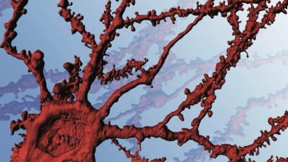 Misconnections in Developmental Disorders and Addiction