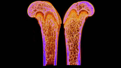 Scientists Discover a New Hormone that Can Build Strong Bones