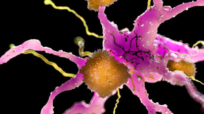 New Treatment Framework for Anti-Amyloid Therapies Developed by UCSF-led Alzheimer’s Association Consortium