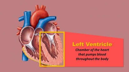 Johns Hopkins Medicine Documents Stroke Risk in Cardiac Assist Device