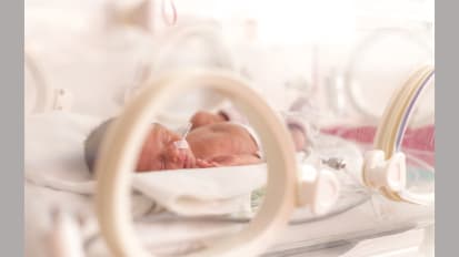 Study Finds Female Babies with Congenital Diaphragmatic Hernia Have Slightly Higher Risk of Death