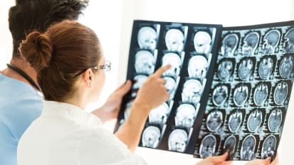 Cedars-Sinai Study Leverages Oncology Research to Improve Outcomes for Patients with Aggressive Prolactinomas