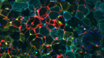 Scientists Discover How to Make Ordinary Fat Cells Burn Calories