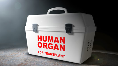 Solid Organ Donation After Death in the United States: Data Driven Messaging to Encourage Potential Donors