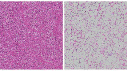 Defect in Gene Caused Massive Obesity in Mice Despite Normal Food Intake