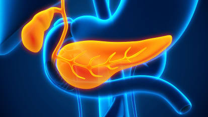 Innovative Approaches Needed to Move the Needle on Pancreatic Cancer