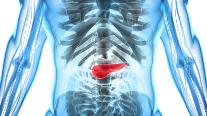 Are Functional Bowel Disorders Often Mistaken for Chronic Pancreatitis?