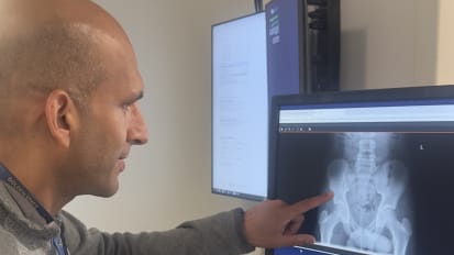 Advancing Pediatric Fracture Care Through Research