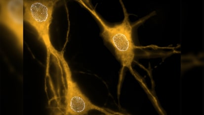 UTSW study reveals how key protein affects neuron structure