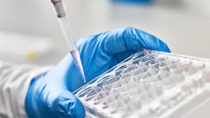 Test Detects Parkinson’s Disease Before Symptoms Present