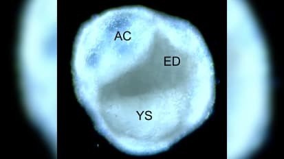 UT Southwestern stem cell biologists develop embryo model