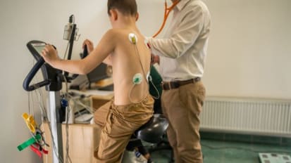 Early Experience Using Implanted Hemodynamic Monitor (CardioMEMs) for Hemodynamic Assessment during Exercise in Pediatric Patients with Fontan Circulation