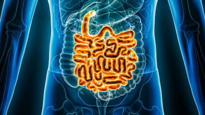 UTSW researchers identify driver of inflammatory bowel disease