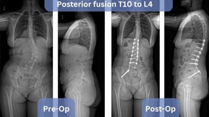 A New Approach to Preserving Spine Mobility in Middle-aged Adults