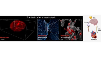 After a Heart Attack, the Heart Signals to the Brain to Increase Sleep to Promote Healing