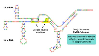 Researchers Identify a Genetic Cause of Intellectual Disability Affecting Tens of Thousands