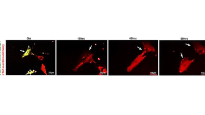 A Specific Human Gene Can Help the Heart Repair Itself From Heart Attack or Heart Failure