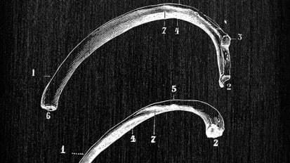 Establishing a Chest Wall Injury Center Provides Long-Awaited Answers